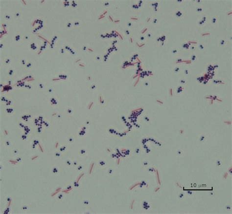 E Coli Gram Stain