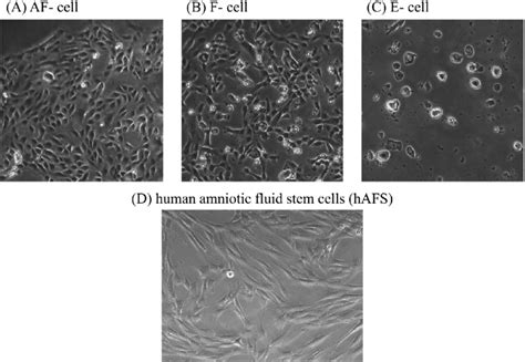 Morphological Characteristics Of Amniotic Fluid Cells And Afs