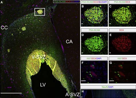 Neuroblast Migration Along Cellular Substrates In The Developing