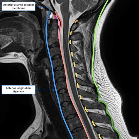 Anterior Longitudinal Ligament Ligaments Of The Vertebral Column