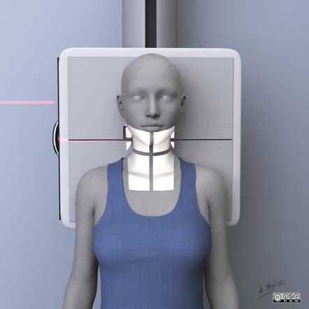 Ap cervical spine x ray positioning - cancerbery