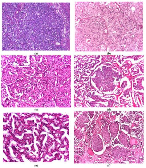 Biomedicines Free Full Text Clinicopathological Profile Of