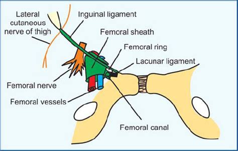 Femoral Ring Boundaries