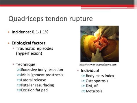 Extensor Mechanism Lesions After Total Knee Arthroplasty Sergio