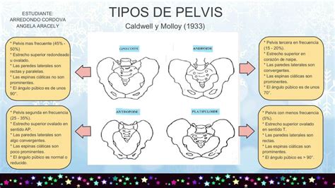 Tipos De Pelvis Angela Arredondo Obstetricia UDocz