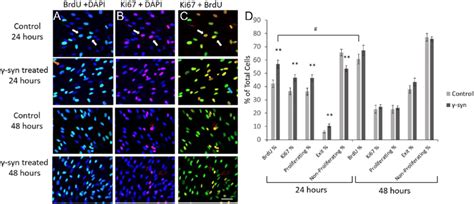 immunocytochemistry analysis  brdu ki  dapi colocalization