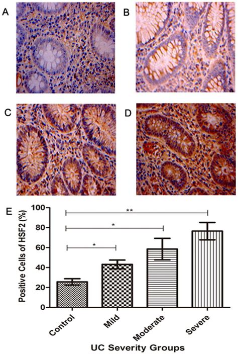 Expression Of HSF2 In Colonic Mucosa Tissues Of Normal Control And UC