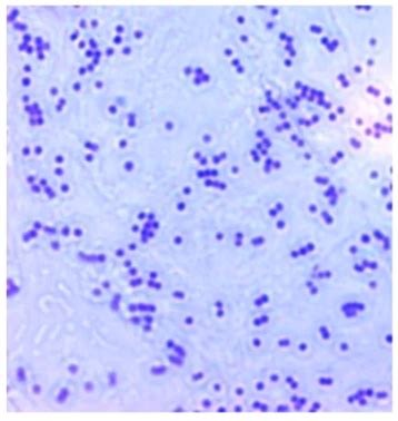 Staphylococcus MRSA Flashcards Quizlet