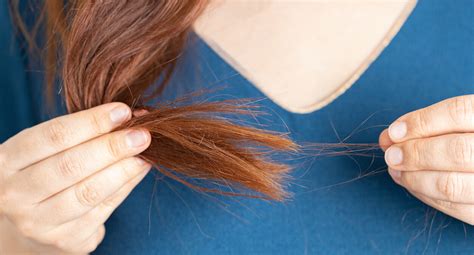 Estudo Alerta Que Efeitos Deste Alimento Podem Causar Queda De Cabelo