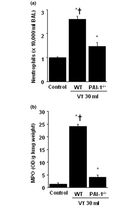 Plasminogen Activator Inhibitor Pai Deficient Mice Reduced Lung