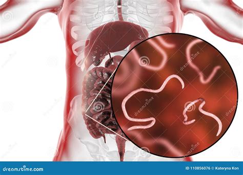 Helminths Nematodes Enterobius In The Gut Stock Illustration