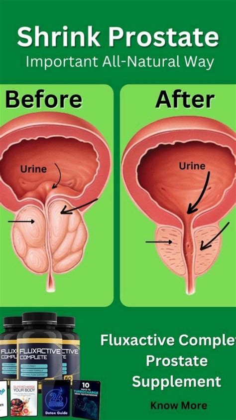 shrink prostate naturally | Prostate health men, Prostate, Prostate health