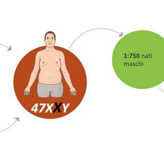 La Sindrome Di Klinefelter Prevalenza E Principali Caratteristiche