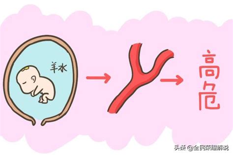 產婦出現羊水栓塞會很危險，若出現這些信號，一定要及時告知醫生 每日頭條