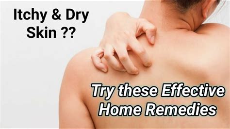 Home Remedies For Itchy Skin Quick Cure For Itching Skin How To