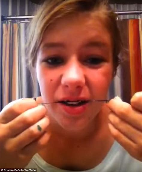 How To Straighten Your Teeth At Home With Rubber Bands Teethwalls