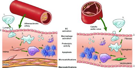 Mechanisms Underlying Arterial And Aortic Valve Calcification This