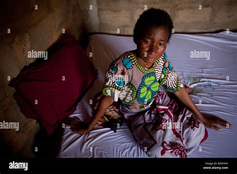 Tuberculosis Treatment Africa Hi Res Stock Photography And Images Alamy