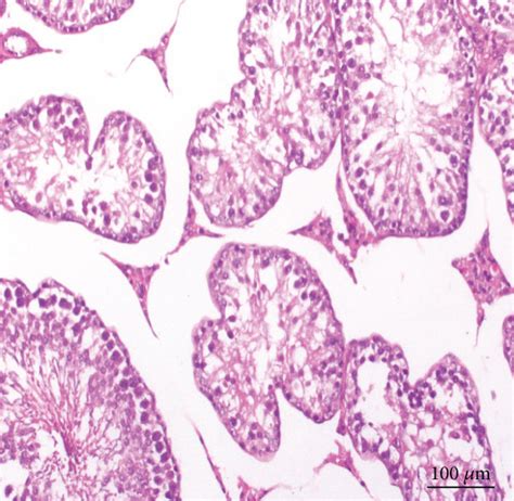 Photomicrographs Of Rat Testis Sections A From The Ra Group Showing