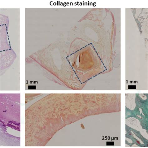 Representative Histological Staining Of Repaired Cartilage For The