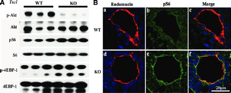 Loss Of Tsc1 Activates Mtor In Endothelial Cells A Western Blotting