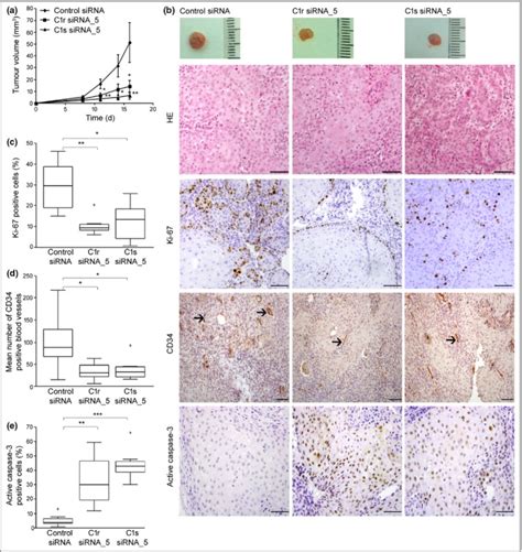 Tumour Cell Derived Complement Components C1r And C1s Promote Growth Of