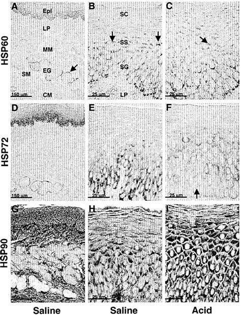 Immunohistochemical Localization Of Hsp60 A C Hsp72 D F And Hsp90