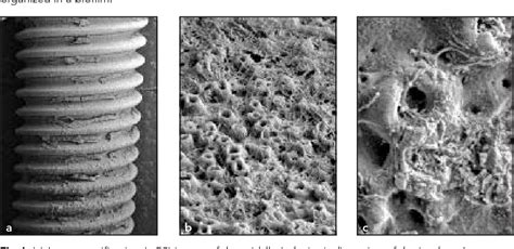 Figure 5 From Bacterial Biofilm Morphology On A Failing Implant With An Oxidized Surface A