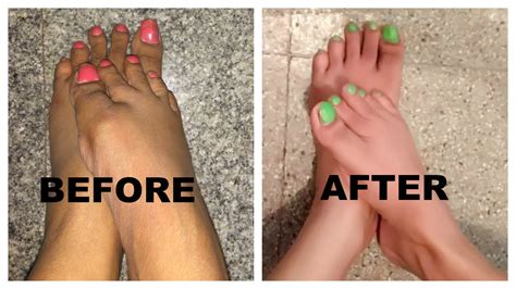 How To Do Pedicure At Home By Using Natural Products Without Any Tools