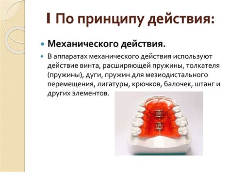 Виды и типы ортодонтических аппаратов и основы ортодонтического лечения ...