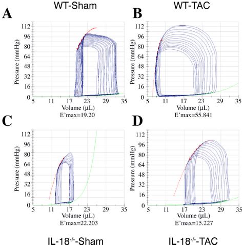 Figure 1 From Interleukin 18 Knockout Mice Display Maladaptive Cardiac