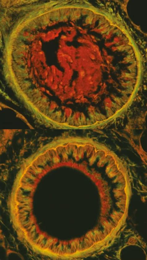 Compound blocks excess mucus secretion in mouse lungs | National ...