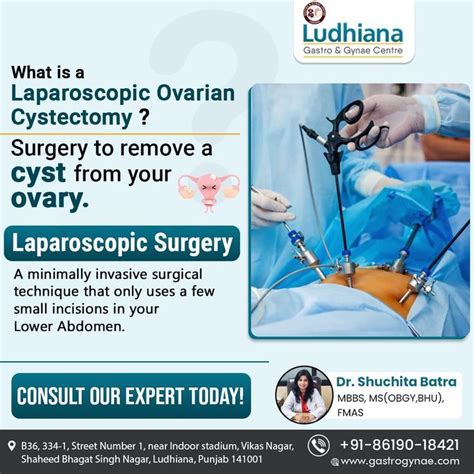 What Is A Laparoscopic Ovarian Cystectomy Laparoscopic Surgery