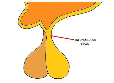 Infundibular Stalk Definition — Neuroscientifically Challenged