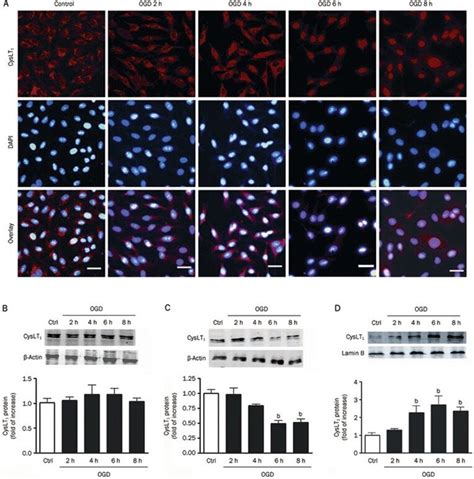 Ogd Time Dependently Induces Nuclear Translocation Of The Cyslt