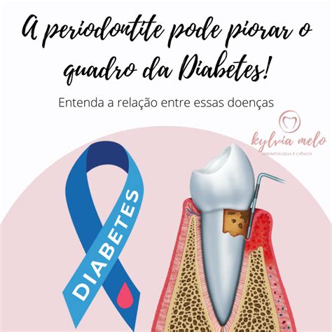 Rela O Entre Periodontite E Diabetes Periodontia