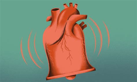 Infarctus du myocarde Comment réagir et se rétablir Conseils UFC