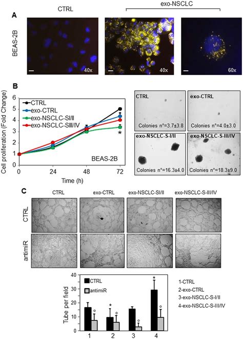 Nsclc Derived Exosomes At Early And Advanced Stages Affect Cell