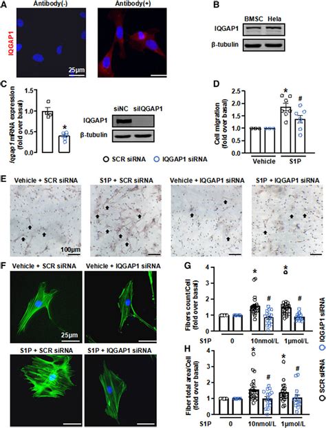 IQGAP1 Is Involved In S1P Induced Migration Of BMSCs A And B The