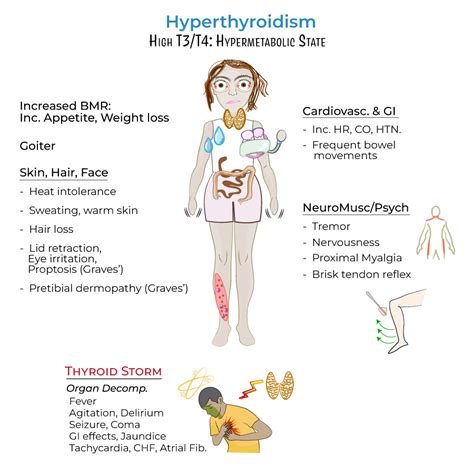 USMLE COMLEX Step 1 Glossary Thyroid Disorders For USMLE Step 1