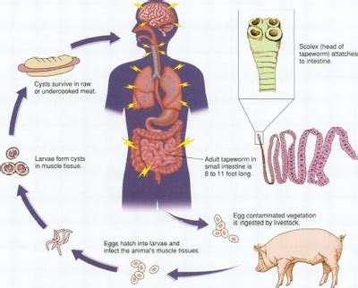 Helminths - Microbiology and Parasitology