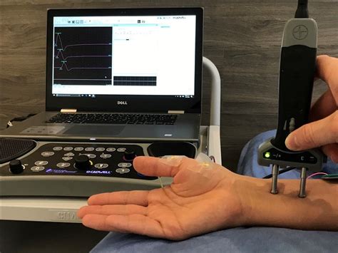 ELECTROMIOGRAFÍA AVANZADA Y NEUROCONDUCCIÓN MOTORA Y SENSITIVA Neuropluss