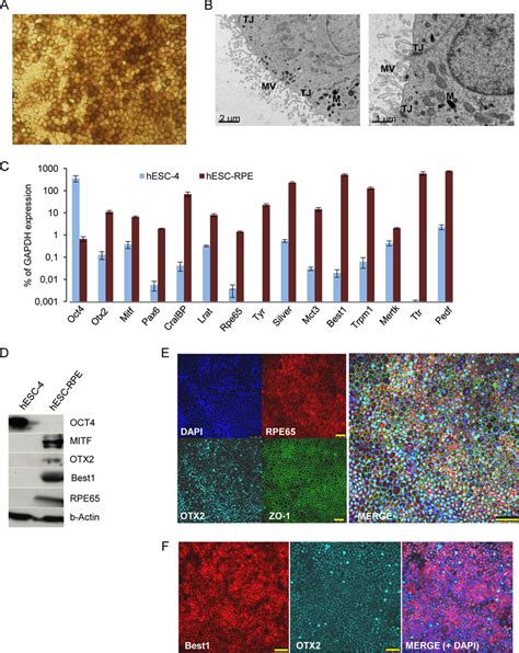 Characterization Of Hesc Derived Rpe Cells Pigmented Clusters Of