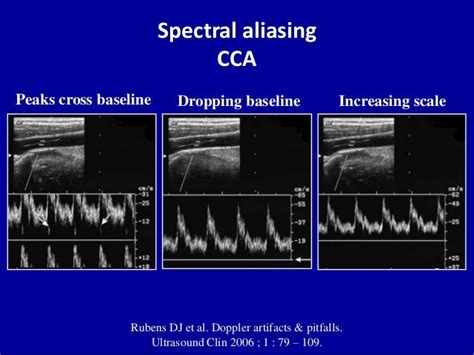 Principles Of Doppler Ultrasound