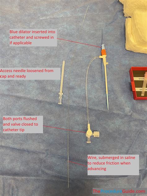 Ultrasound Guided Seldinger Venous Access Technique And Overview