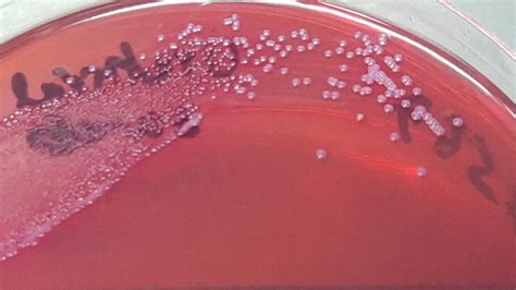 Staphylococcus haemolyticus-Introduction, Morphology, Pathogen