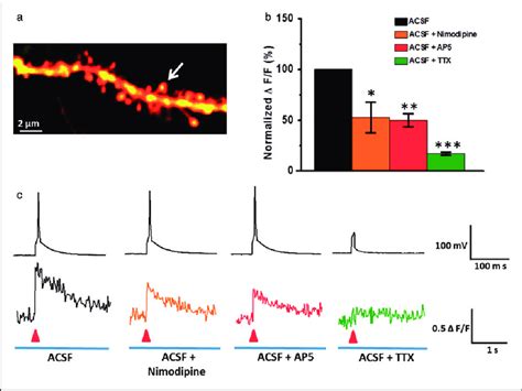 NMDA Receptors And VGCCs Both Mediated Single AP Evoked Suprathreshold