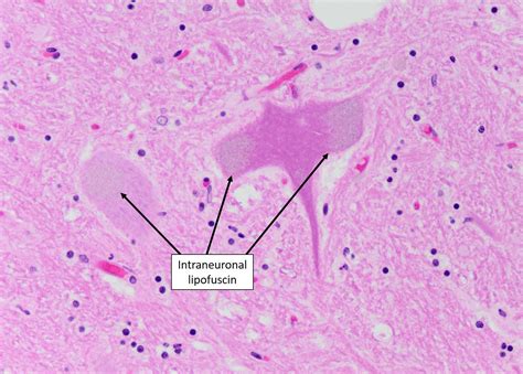 Cell Inclusions – Veterinary Histology