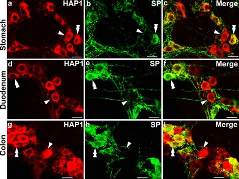 Double Label Immunofluorescence Immunohistochemistry For HAP1 With SP