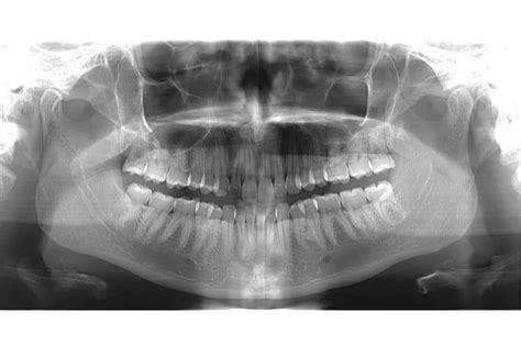 Cone Beam Ct Scan: A New Era for Diagnosis & Treatment | Facial Imaging ...